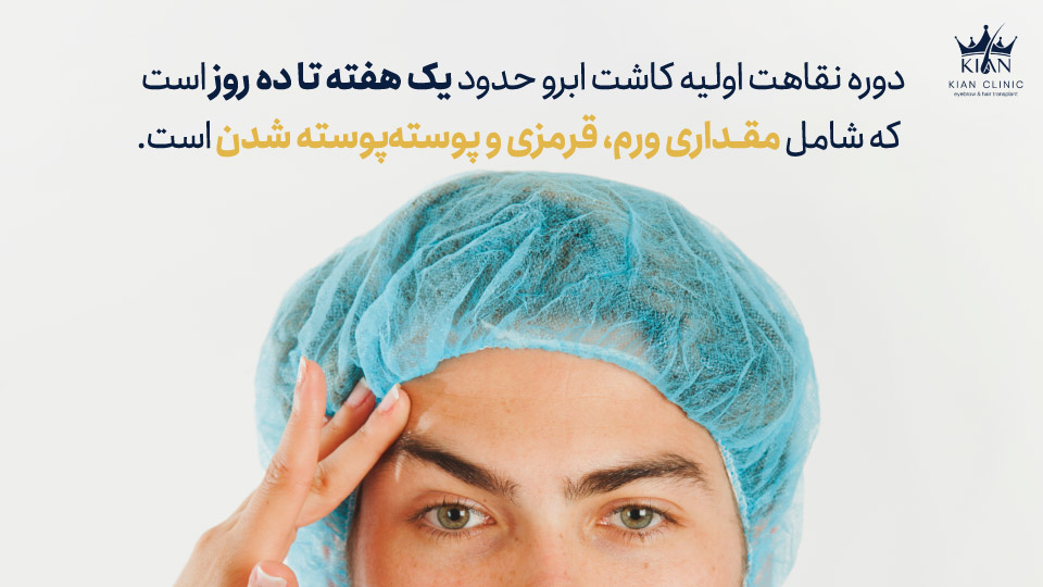 دوره نقاهت اولیه کاشت ابرو حدود یک هفته تا ده روز است که شامل مقداری ورم، قرمزی و پوستهپوسته شدن است.