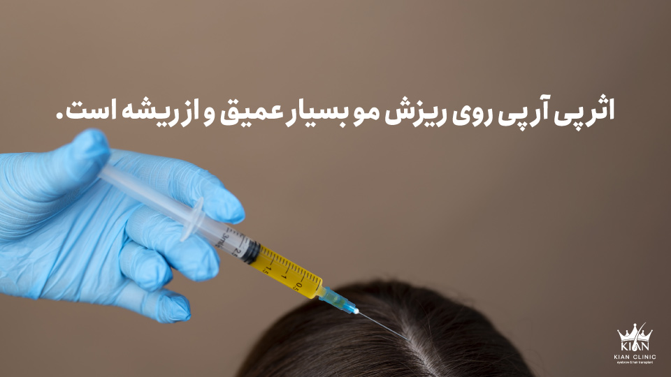 اثر پی آر پی روی ریزش مو بسیار عمیق و از ریشه است.