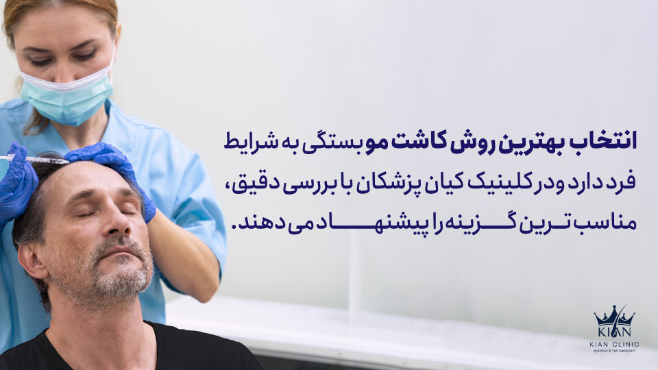 انتخاب بهترین روش کاشت مو بستگی به شرایط فرد دارد و در کلینیک کیان پزشکان با بررسی دقیق، مناسبترین گزینه را پیشنهاد میدهند.