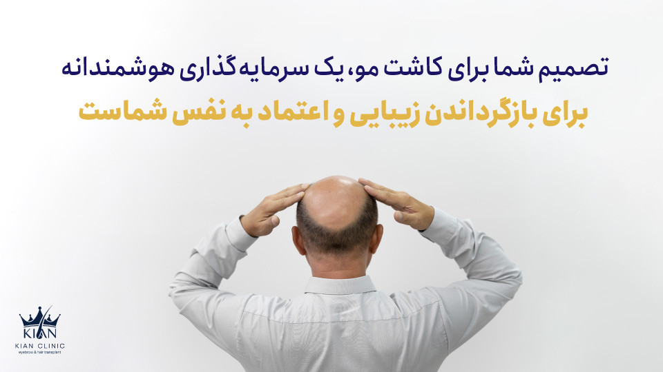 تصمیم شما برای کاشت مو، یک سرمایهگذاری هوشمندانه برای بازگرداندن زیبایی و اعتماد به نفس شماست