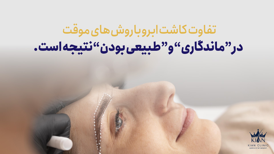 تفاوت کاشت ابرو با روشهای موقت در "ماندگاری" و "طبیعی بودن" نتیجه است.