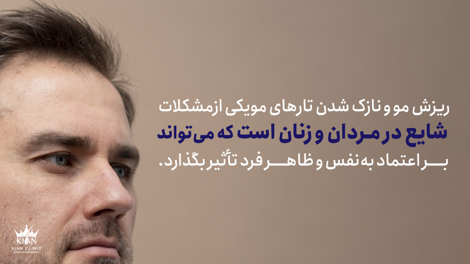 ریزش مو و نازک شدن تارهای مو یکی از مشکلات شایع در مردان و زنان است که میتواند بر اعتمادبهنفس و ظاهر فرد تأثیر بگذارد.
