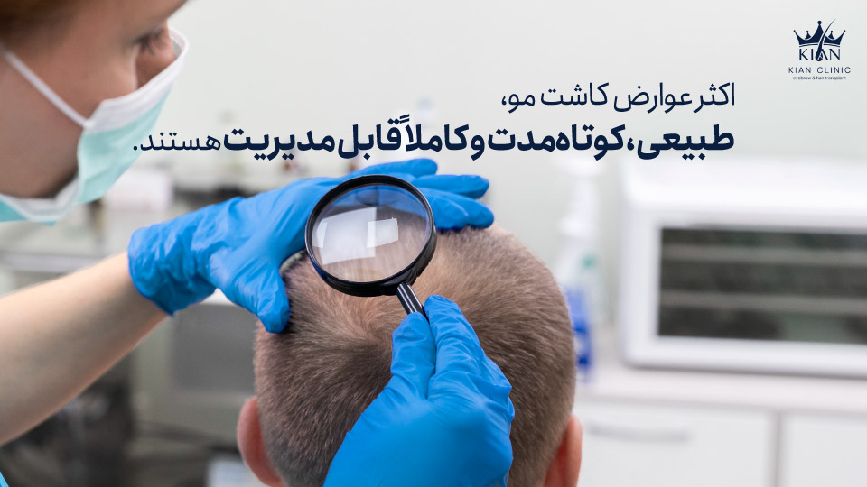 اکثر عوارض کاشت مو، طبیعی، کوتاهمدت و کاملاً قابل مدیریت هستند