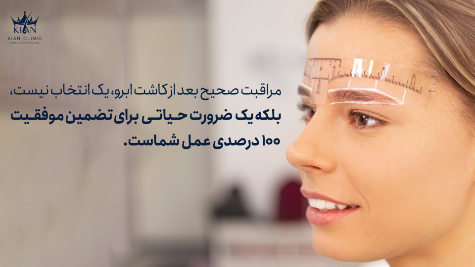 مراقبت صحیح بعد از کاشت ابرو، یک انتخاب نیست، بلکه یک ضرورت حیاتی برای تضمین موفقیت ۱۰۰ درصدی عمل شماست