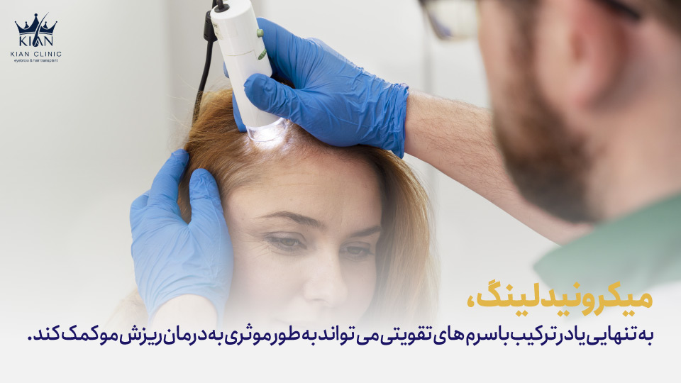 میکرونیدلینگ به تنهایی یا در ترکیب با سرمهای تقویتی میتواند به طور موثری به درمان ریزش مو کمک کند.