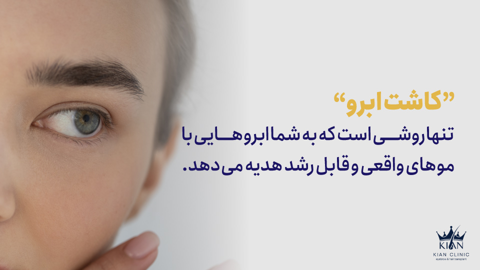 "کاشت ابرو" تنها روشی است که به شما ابروهایی با موهای واقعی و قابل رشد هدیه میدهد.
