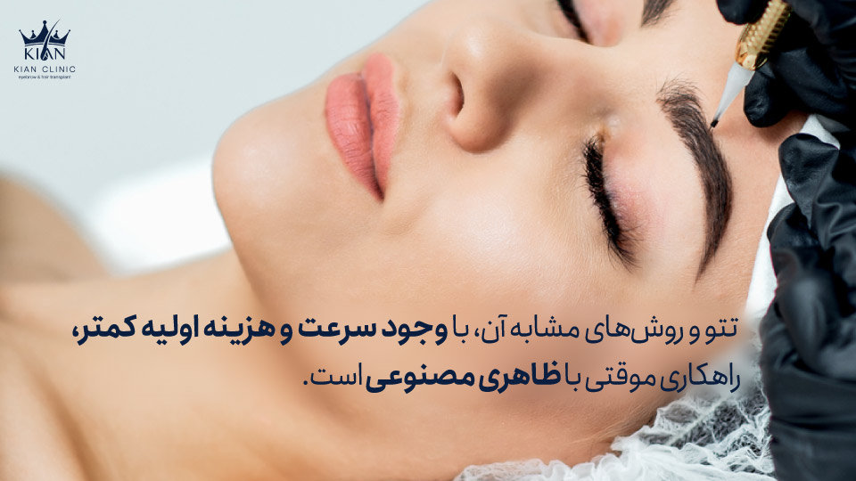 تتو و روشهای مشابه آن، با وجود سرعت و هزینه اولیه کمتر، راهکاری موقتی با ظاهری مصنوعی است