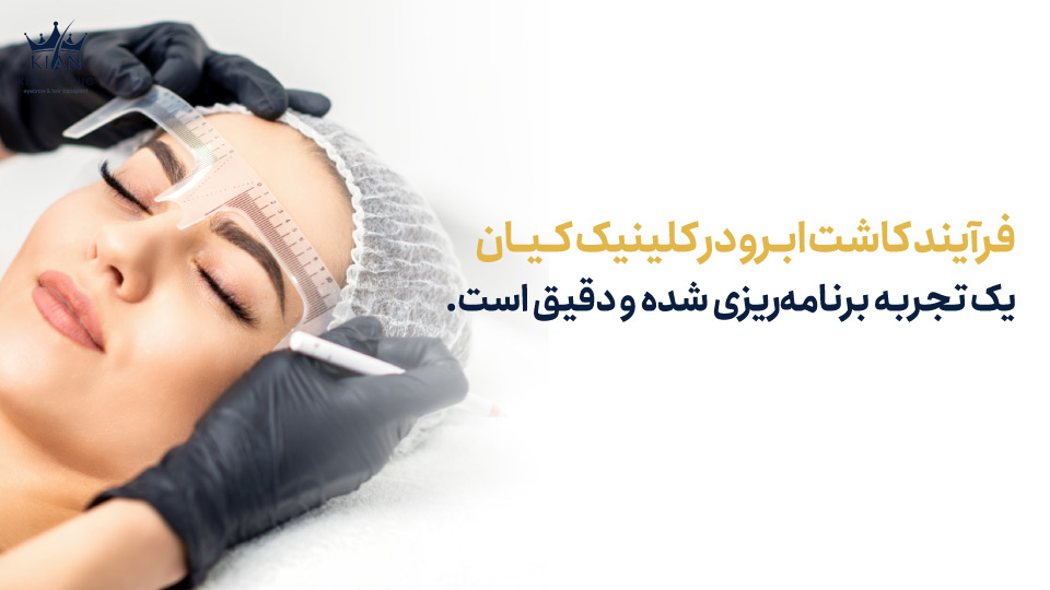 فرآیند کاشت ابرو در کلینیک کیان یک تجربه برنامهریزی شده و دقیق است.