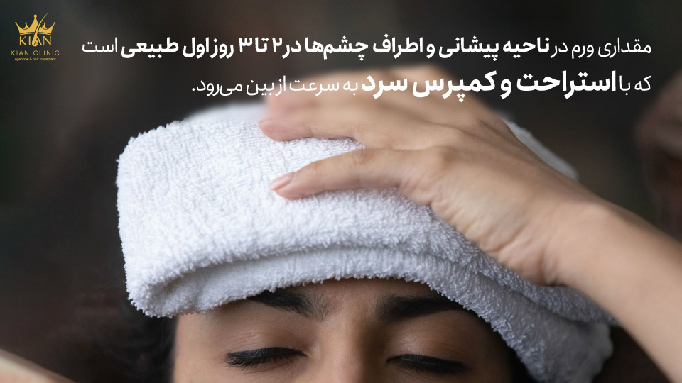 مقداری ورم در ناحیه پیشانی و اطراف چشمها در ۲ تا ۳ روز اول طبیعی است که با استراحت و کمپرس سرد به سرعت از بین میرود.