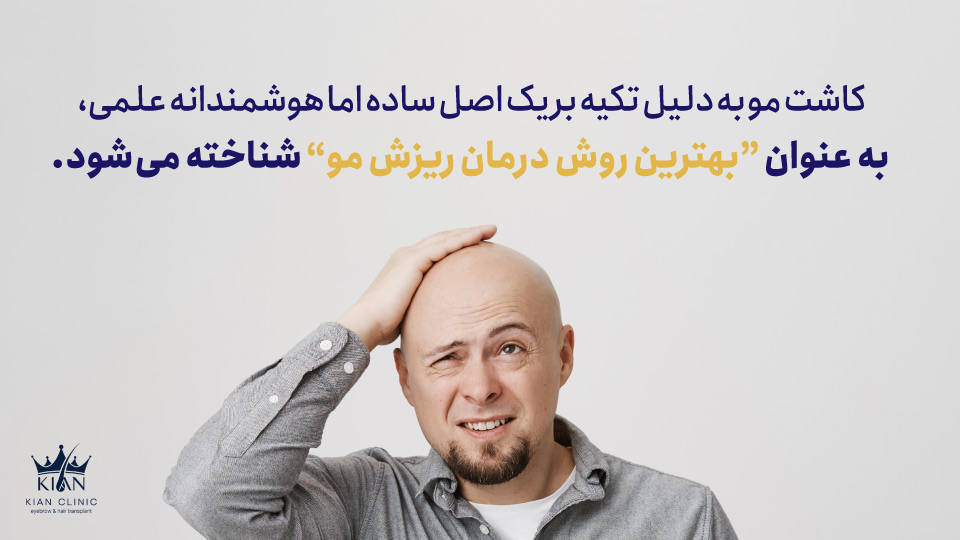 کاشت مو به دلیل تکیه بر یک اصل ساده اما هوشمندانه علمی، به عنوان "بهترین روش درمان ریزش مو" شناخته میشود.