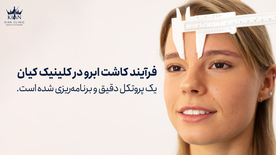 فرآیند کاشت ابرو در کلینیک کیان یک پروتکل دقیق و برنامهریزی شده است.