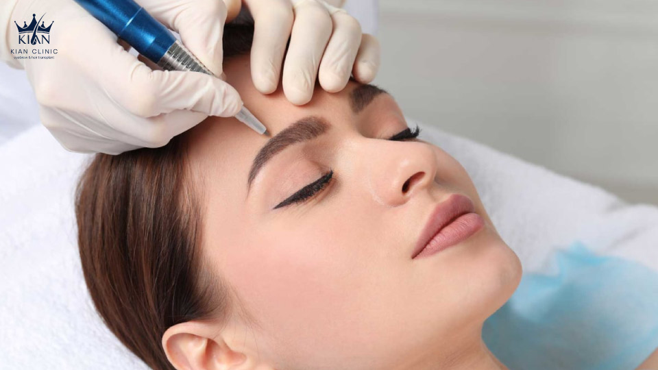 کاشت ابرو در مقایسه با میکروبلیدینگ