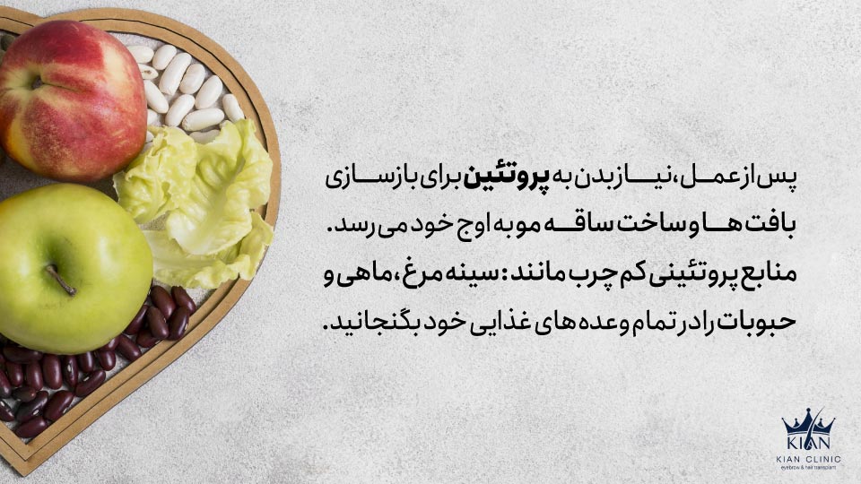 پس از عمل، نیاز بدن به پروتئین برای بازسازی بافتها و ساخت ساقه مو به اوج خود میرسد. منابع پروتئینی کمچرب مانند سینه مرغ، ماهی و حبوبات را در تمام وعدههای غذایی خود بگنجانید.