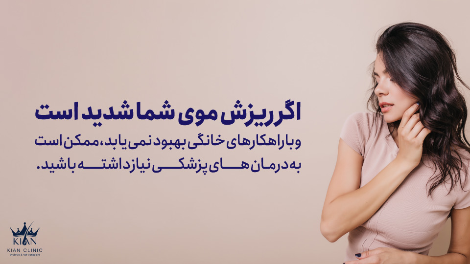 اگر ریزش موی شما شدید است و با راهکارهای خانگی بهبود نمییابد، ممکن است به درمانهای پزشکی نیاز داشته باشید.