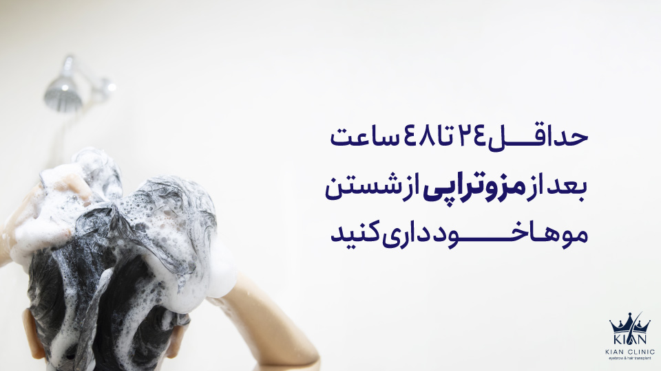 حداقل ۲۴ تا ۴۸ ساعت بعد از مزوتراپی از شستن موها خودداری کنید