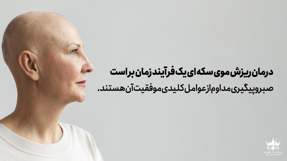 درمان ریزش موی سکه ای یک فرآیند زمان بر است و صبر و پیگیری مداوم از عوامل کلیدی موفقیت آن هستند.