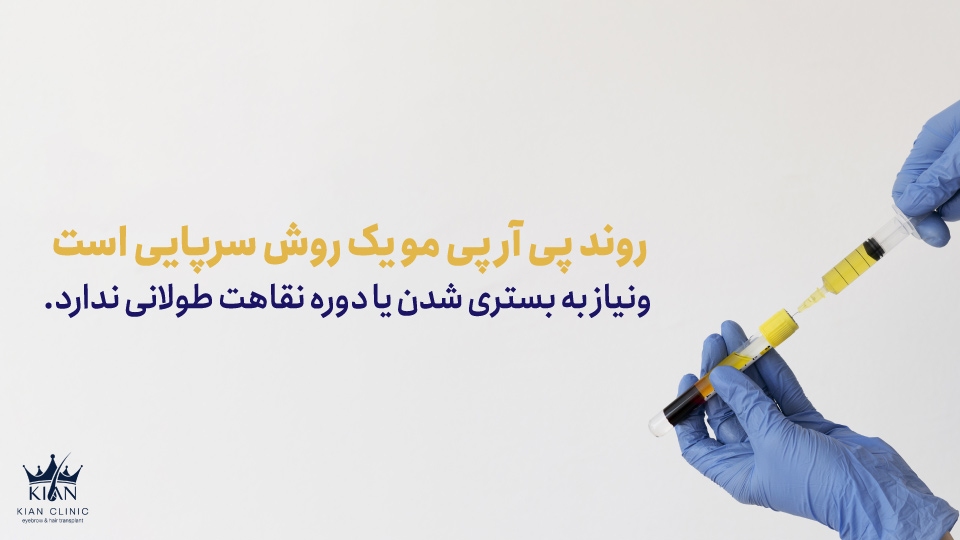 روند پی آر پی مو یک روش سرپایی است و نیاز به بستری شدن یا دوره نقاهت طولانی ندارد.