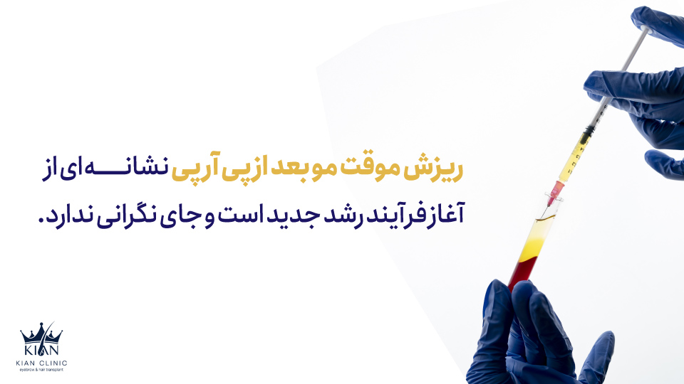 ریزش موقت مو بعد از پی آر پی نشانهای از آغاز فرآیند رشد جدید است و جای نگرانی ندارد.