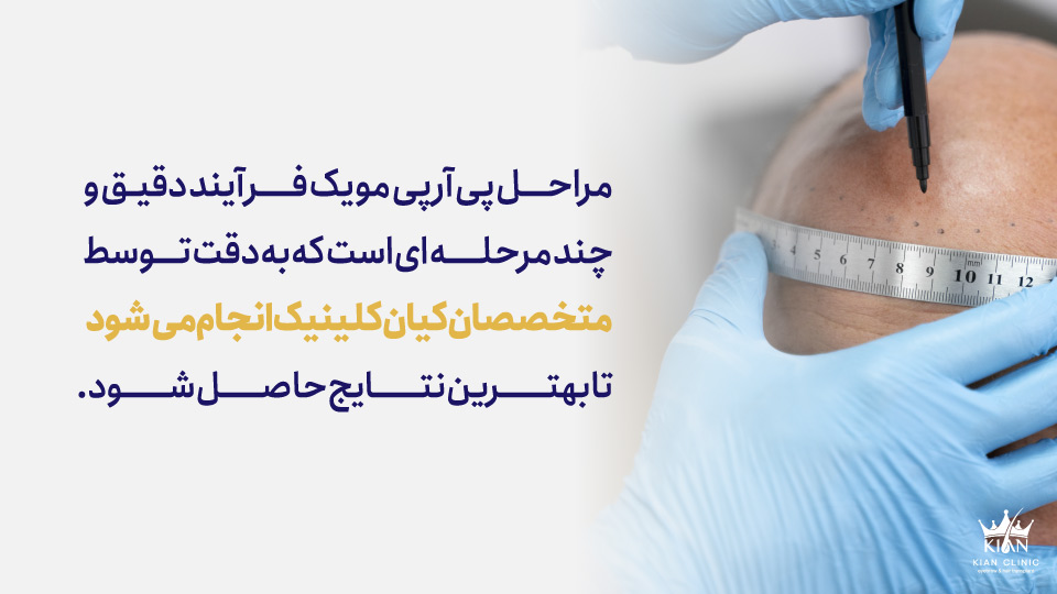 مراحل پی آر پی مو یک فرآیند دقیق و چند مرحلهای است که به دقت توسط متخصصان کیان کلینیک انجام میشود تا بهترین نتایج حاصل شود.