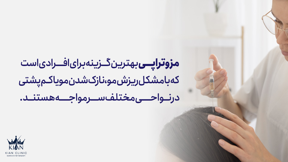 مزوتراپی بهترین گزینه برای افرادی است که با مشکل ریزش مو، نازک شدن مو یا کمپشتی در نواحی مختلف سر مواجه هستند.