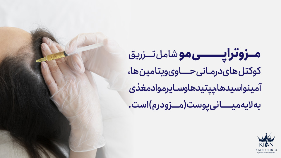 مزوتراپی مو شامل تزریق کوکتلهای درمانی حاوی ویتامینها، آمینواسیدها، پپتیدها و سایر مواد مغذی به لایه میانی پوست (مزودرم) است.