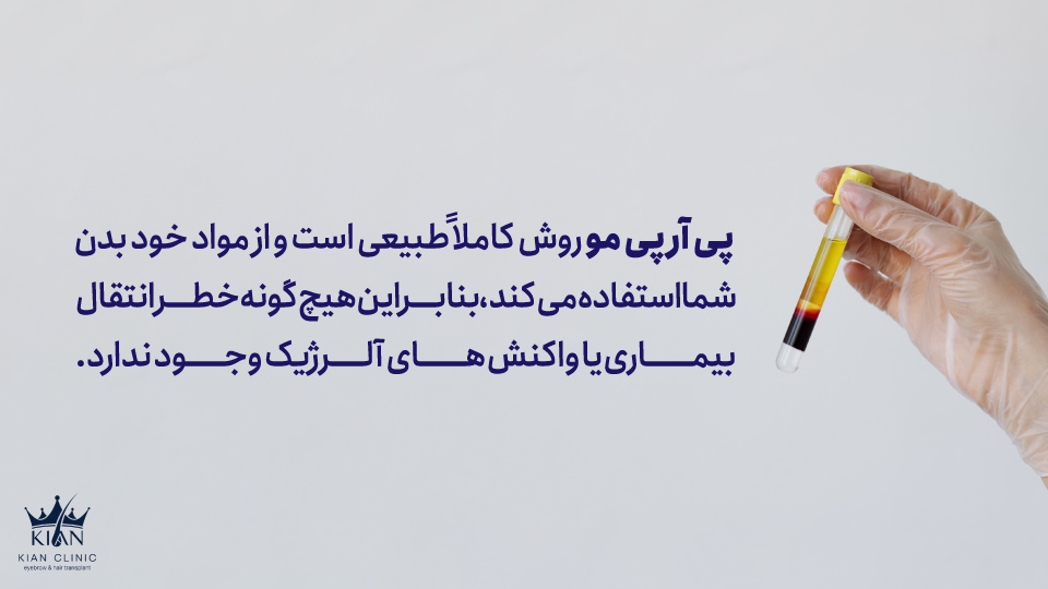 پی آر پی مو روش کاملاً طبیعی است و از مواد خود بدن شما استفاده میکند، بنابراین هیچگونه خطر انتقال بیماری یا واکنشهای آلرژیک وجود ندارد