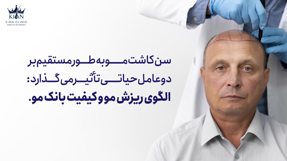 سن کاشت مو به طور مستقیم بر دو عامل حیاتی تأثیر میگذارد: الگوی ریزش مو و کیفیت بانک مو.