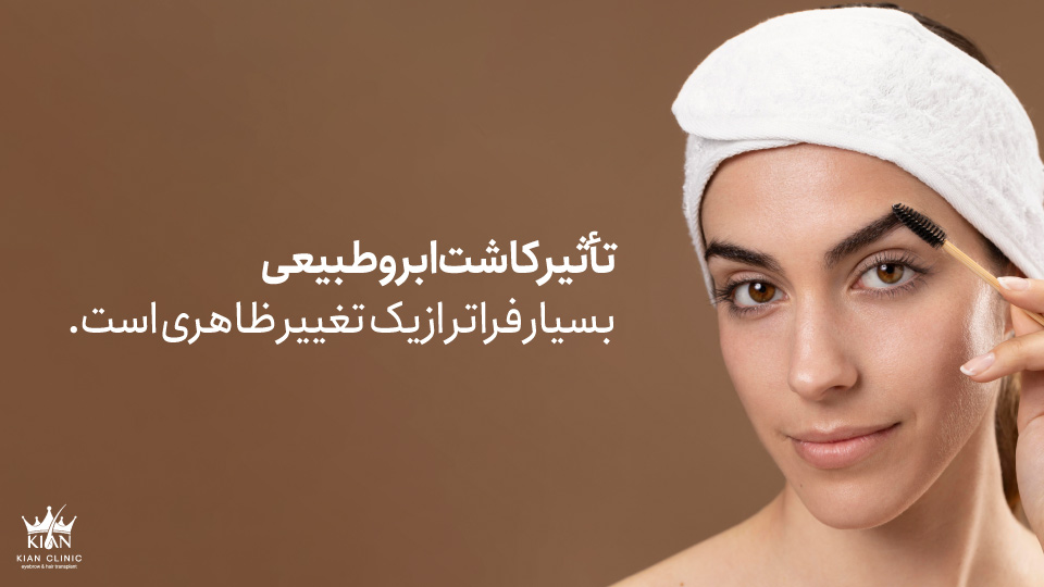 تأثیر کاشت ابرو طبیعی بسیار فراتر از یک تغییر ظاهری است.