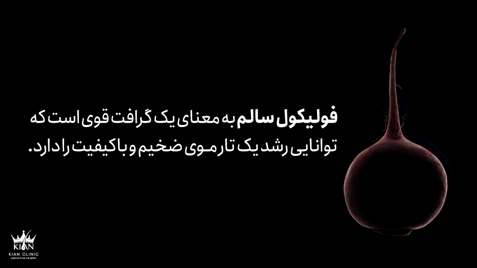 فولیکول سالم به معنای یک گرافت قوی است که توانایی رشد یک تار موی ضخیم و باکیفیت را دارد.