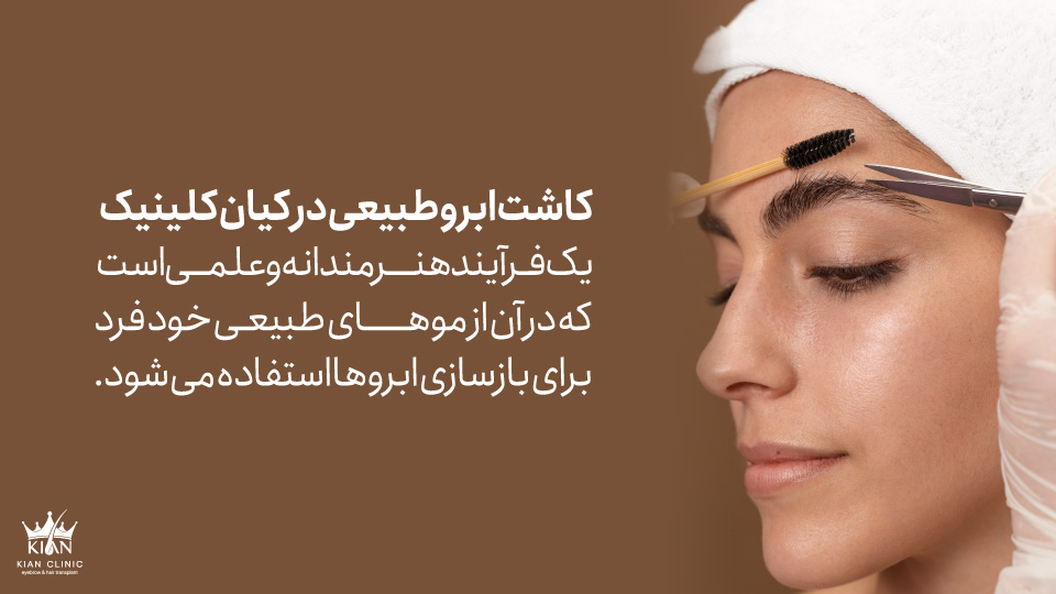 کاشت ابرو طبیعی در کیان کلینیک یک فرآیند هنرمندانه و علمی است که در آن از موهای طبیعی خود فرد برای بازسازی ابروها استفاده میشود.