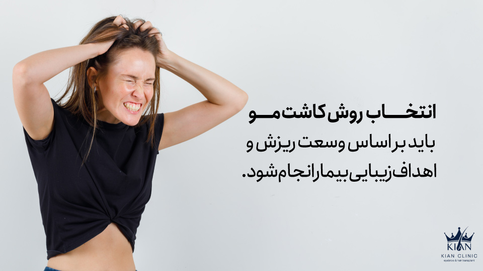 انتخاب روش کاشت مو باید بر اساس وسعت ریزش و اهداف زیبایی بیمار انجام شود.