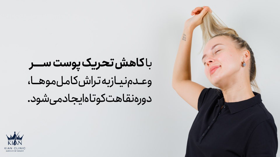 با کاهش تحریک پوست سر و عدم نیاز به تراش کامل موها، دوره نقاهت کوتاه ایجاد می شود