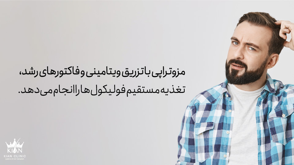 مزوتراپی با تزریق ویتامینی و فاکتورهای رشد، تغذیه مستقیم فولیکول ها را انجام می دهد.