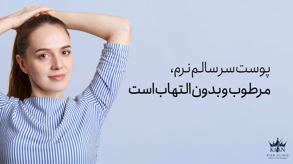 پوست سر سالم نرم، مرطوب و بدون التهاب است